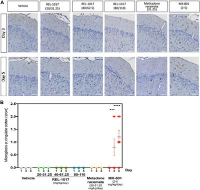 REL-1017 (Esmethadone), A Novel NMDAR Blocker for the Treatment of MDD is Not Neurotoxic in Sprague-Dawley Rats